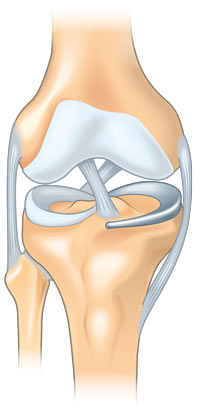 Knee TMR