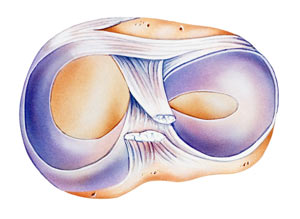 Tibial Plateau